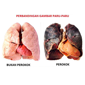 paru-paru-normal-dan-perokok