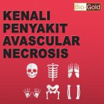 Ketahui Penyebab Avascular necrosis Jelly Gamat