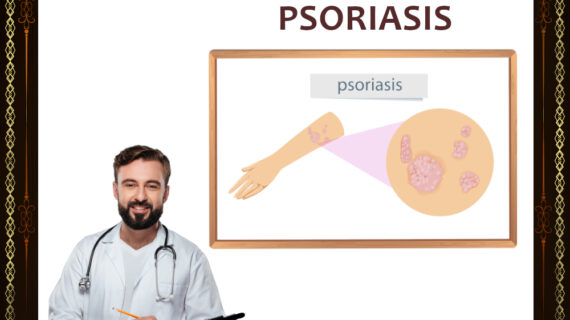 Cara Mengatasi Psoriasis - gamatbiogold.com